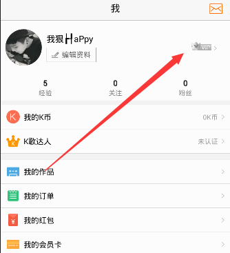 男子吃小龙虾过敏双眼肿成悲伤蛙